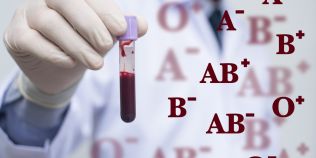 De ce poate fi fatala transfuzia cu alt tip de sange. 